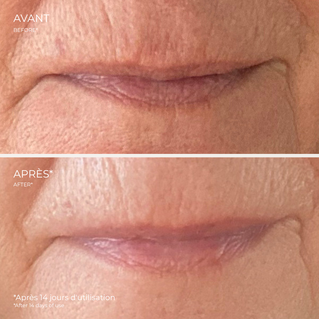 Eye & Lip Contour Cream | Hydra Lift - Zorah biocosmétiques
